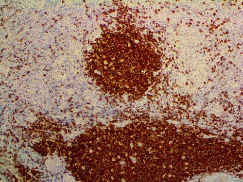 IHC of CD19 on an FFPE Spleen Tissue